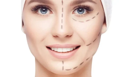 Armonización Facial: La Clave para Revelar Tu Belleza Única
