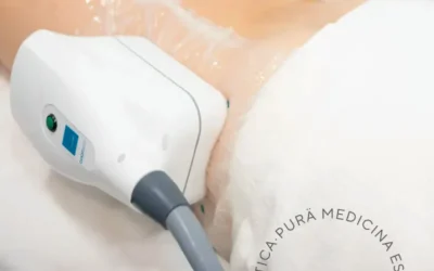 Criolipólisis en Málaga: Descubre el Precio y los Beneficios de Este Tratamiento de Belleza